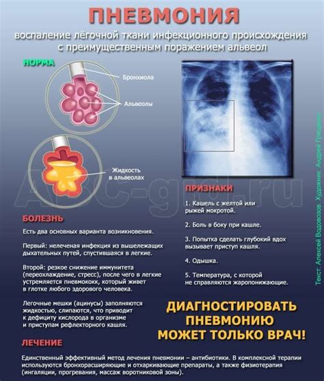 Роль Ренгалина в битве с пневмонией у взрослых