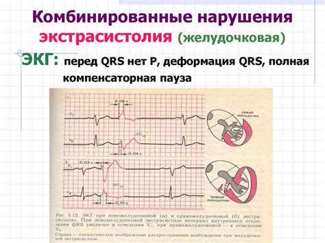 Роль воспаления в повышении сердечного ритма у ожиревших