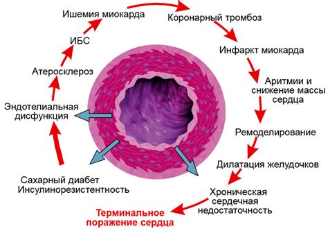 Роль гликемии в развитии второго типа сахарного диабета: важность понимания взаимосвязи