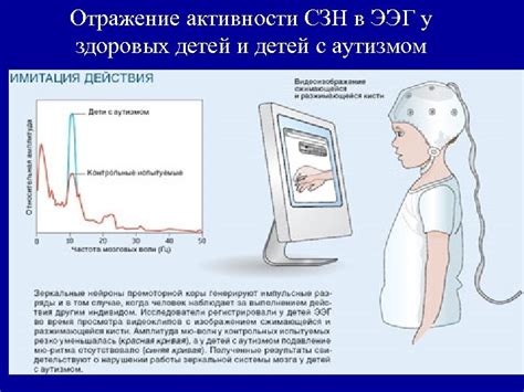 Роль зеркальных нейронов в передаче эффекта почесухи