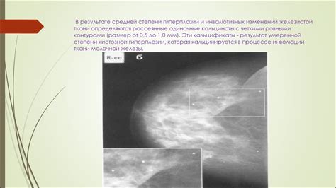 Роль молекулярной диагностики в выявлении онкологических заболеваний молочной железы