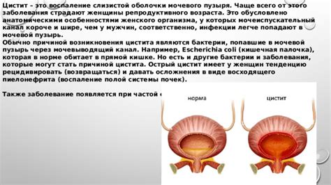 Роль слизистой оболочки мочевого пузыря в удержании физиологического уровня влаги