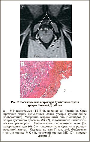 Роль функциональной магнитно-резонансной томографии в изучении речи