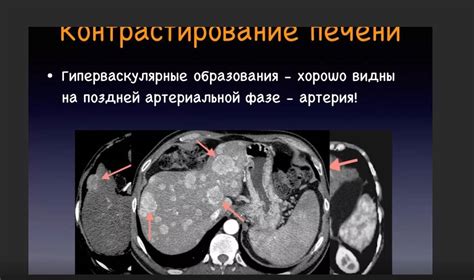 Самостоятельные действия при обнаружении новообразований в печени: