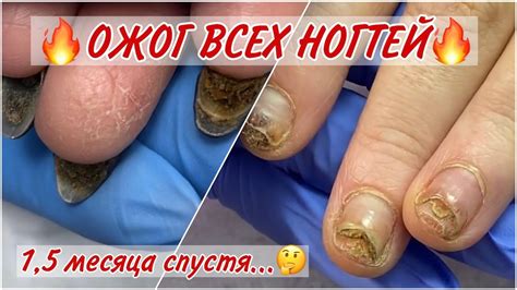 Самые эффективные методы освобождения ногтевой пластины от грязи и сора