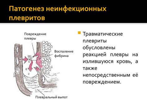 Связь между уровнем гормона стресса в плевральной жидкости и состоянием эмоционального благополучия
