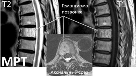 Связь Th11 позвонка с другими структурами организма