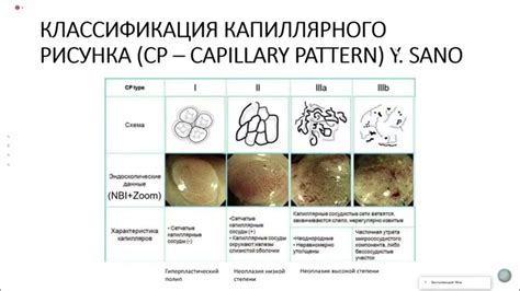 Секреты подготовки к исследованию толстой кишки для оптимальных результатов и удобства
