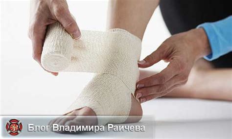Секреты применения охлаждения при растяжении связок