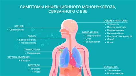 Симптомы вирусного мононуклеоза