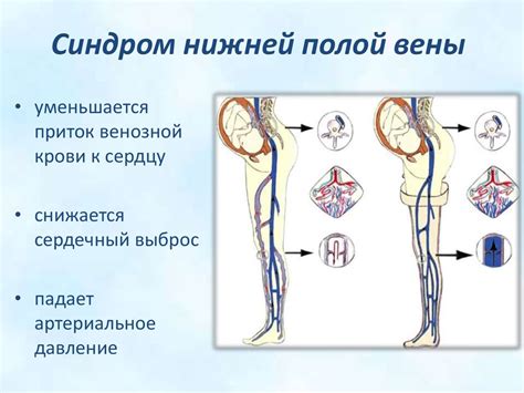 Симптомы возможных проблем с клапанами нижней полой вены