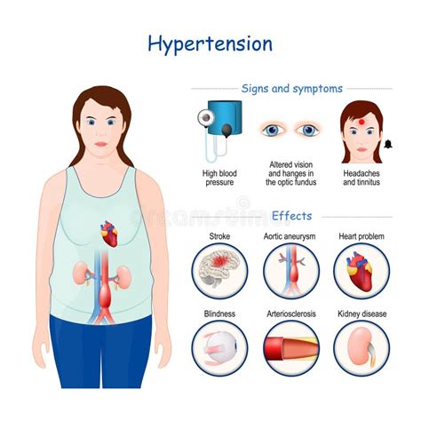 Симптомы высокого кровяного давления