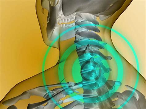 Симптомы и диагностика застуды нерва на спине: как распознать и правильно диагностировать проблему