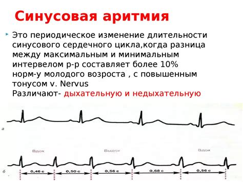 Симптомы нарушений сердечного ритма у маленьких пациентов