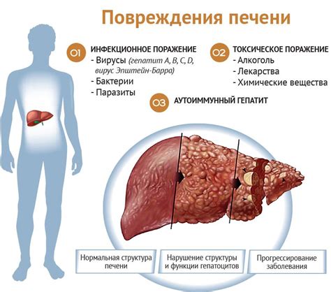 Симптомы новообразования в печени