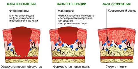 Симптомы ожога от лекарственного препарата