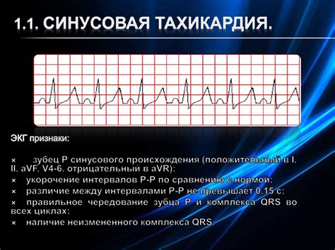 Синусовая тахикардия: причины и симптомы