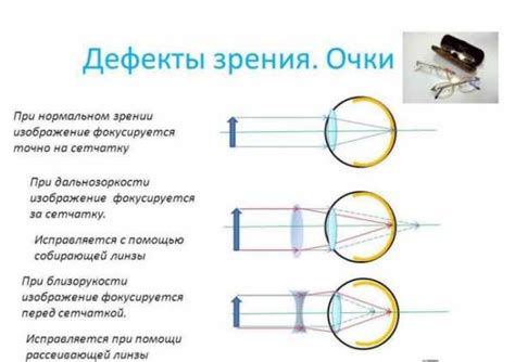 Снижение расходов на зрение: преимущества экономичных очков