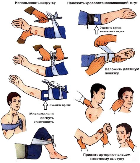 Спасение пострадавшего при ране и последующая остановка кровотечения