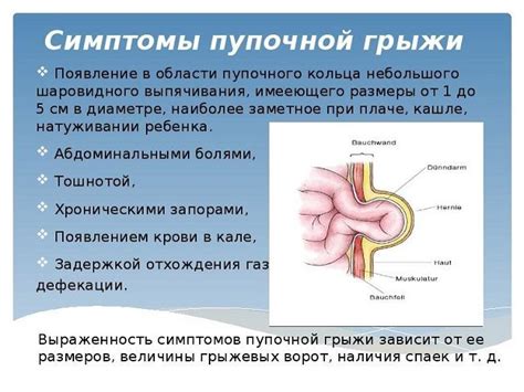 Степени пупочной грыжи и возможные осложнения