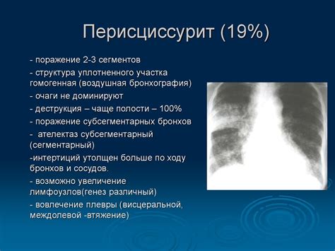 Стоимость проведения диагностики органов дыхания в Туле