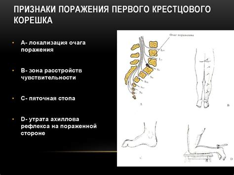 Структура узлов крестцовых корешков: основные черты