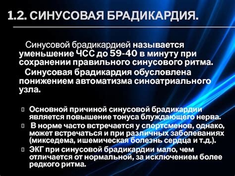 Суть и связь между синусовой брадикардией и работой в структурах Министерства внутренних дел