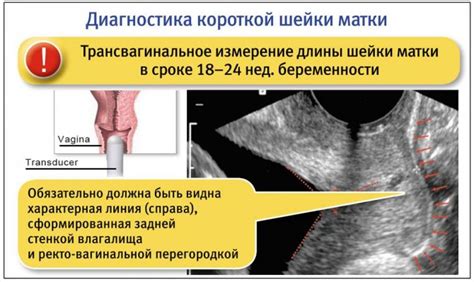 Сущность проблемы: непредвиденная вытекающая жидкостей при закрытой горлышке маточной шейки