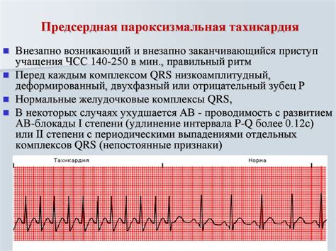 Тахикардия в период беременности: ключевая информация