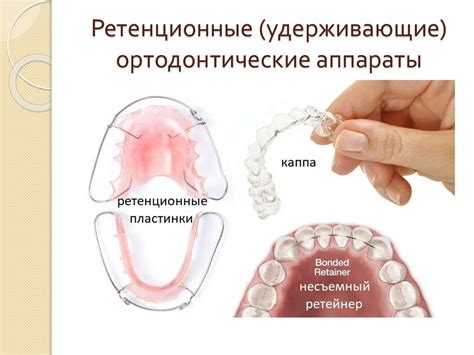 Типы и функции основных ортодонтических аппаратов