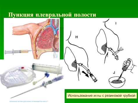 Топографические особенности анатомического расположения плевральной полости в органах дыхания