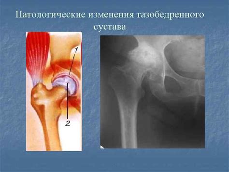 Топография внутренней стороны бедра: основные концепции и структуры