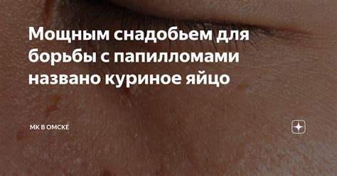 Традиционные методы борьбы с папилломами: выбор эффективных препаратов