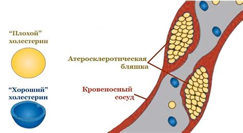 Углеводы высокой плотности и их влияние на проявление целлюлита на бедрах