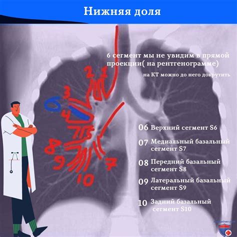 Факторы, приводящие к насыщению изображения легких на рентгеновском снимке