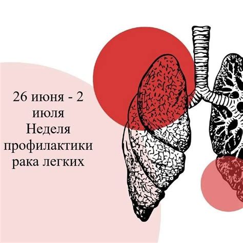 Факторы риска развития вирусного поражения легких