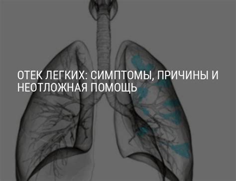 Физиологические аспекты и причины развития отека легких