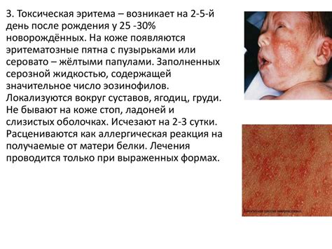 Физиологические особенности новорожденного