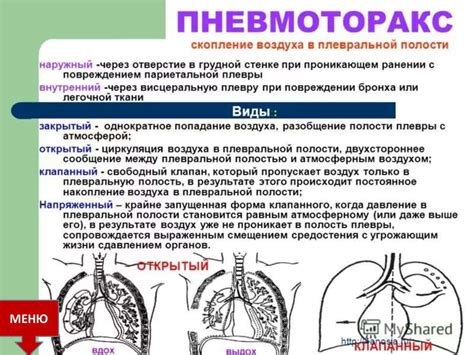 Физиологические особенности человека в состоянии задыхания