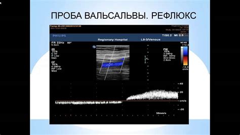 Фокус на кардио-упражнениях с участием нижних конечностей для достижения оптимальных результатов