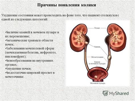 Характеристика появления акустического отражения в мочевом органе