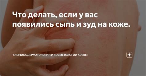 Что делать, если вас посещает зуд