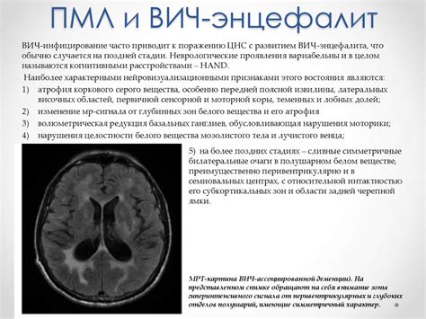 Что такое вирусный энцефалит головного мозга