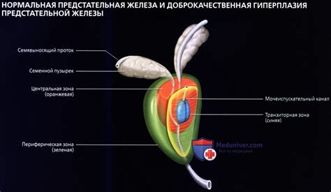 Что такое заражение окружающих нервов и его связь с раком предстательной железы