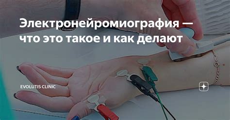 Что такое электронейромиография и как она проходит