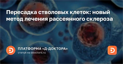 Швейцария: передовые методы по пересадке стволовых клеток в лечении рассеянного склероза