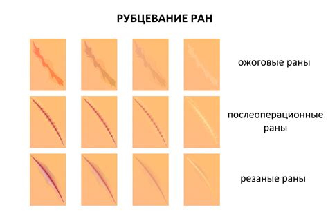 Шрамы: повреждения кожи и вид их происхождения