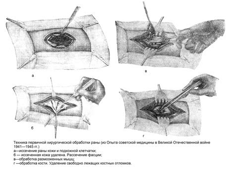 Этапы и методы корректной обработки раны: секреты успешного заживления
