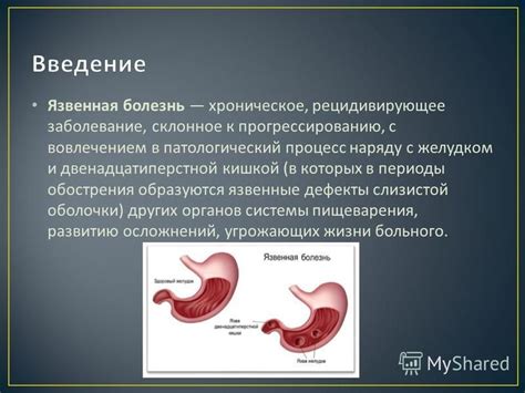 Язвенная болезнь: поражение слизистой оболочки с желудком или двенадцатиперстной кишкой