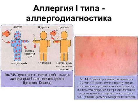  Возможность аллергических реакций и проблем с пищеварением 